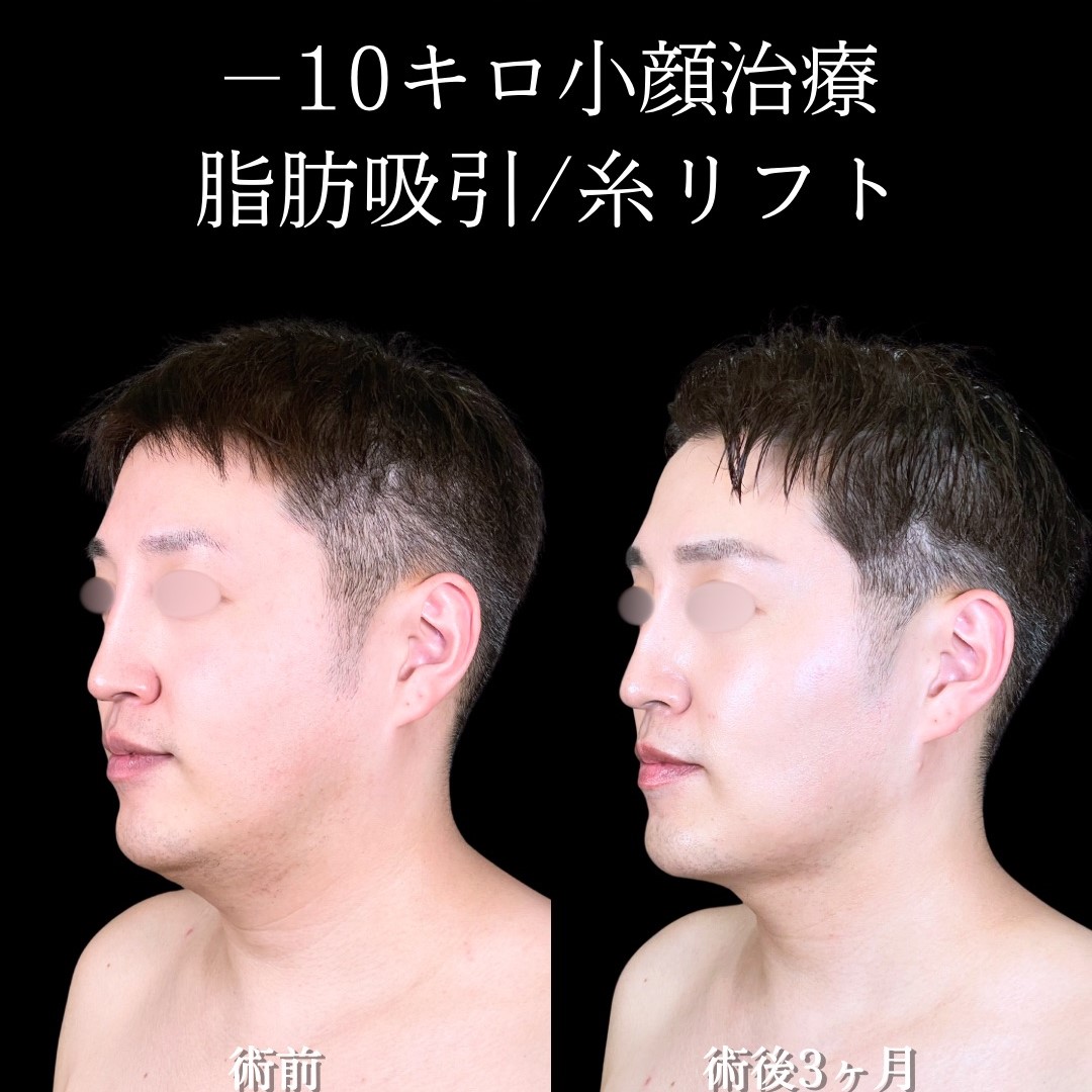 No.16546の症例写真